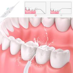 Jato De Agua Limpeza Oral Dental Bucal Power Floss